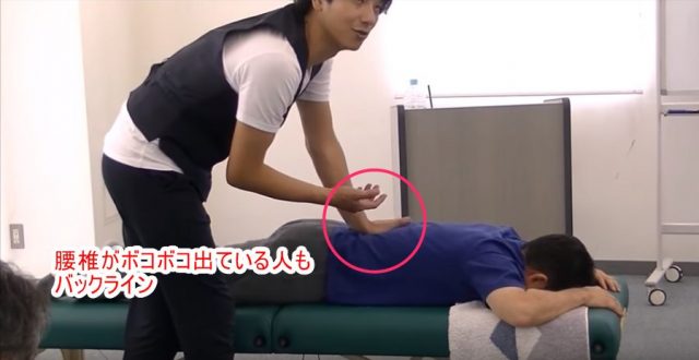 腰椎がボコボコ出ている人もバックライン