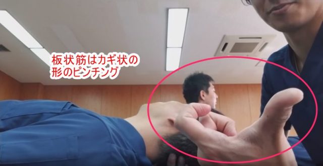板状筋はカギ上のピンチング