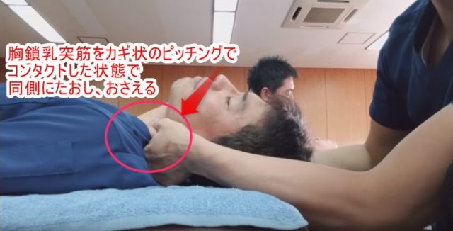 胸鎖乳突筋をカギ状のピンチングでコンタクトした状態で同側に倒し、おさえる