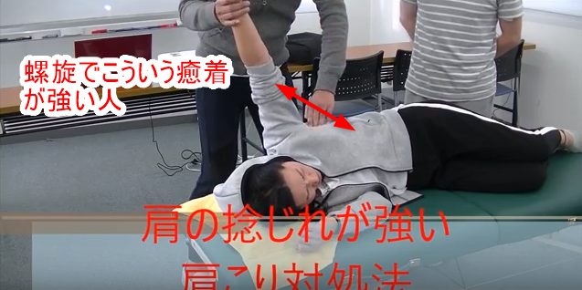 螺旋でこういう癒着が強い人