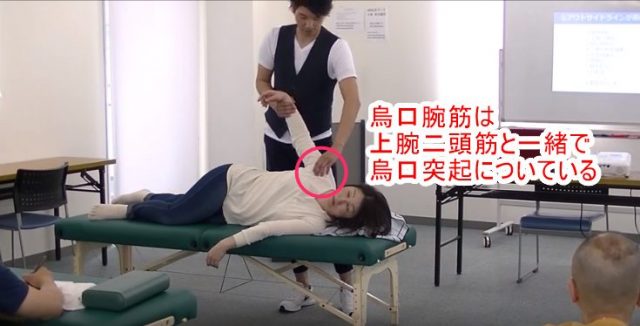 烏口腕筋は上腕二頭筋と一緒で烏口突起についている