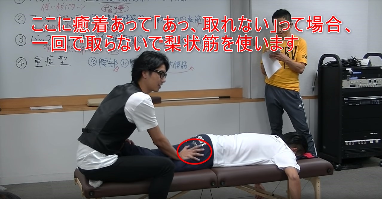 ここに癒着あって「あっ、取れない」って場合、一回で取らないで梨状筋を使います