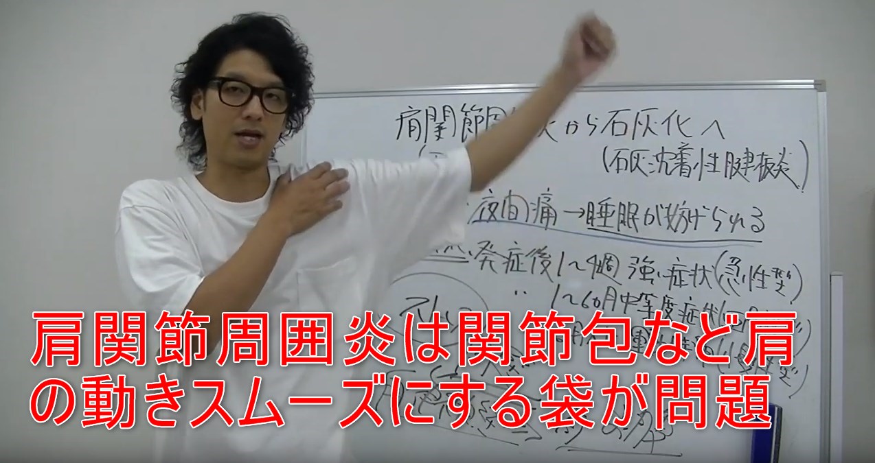 54-13_肩関節周囲炎は関節包など肩の動きスムーズにする袋が問題