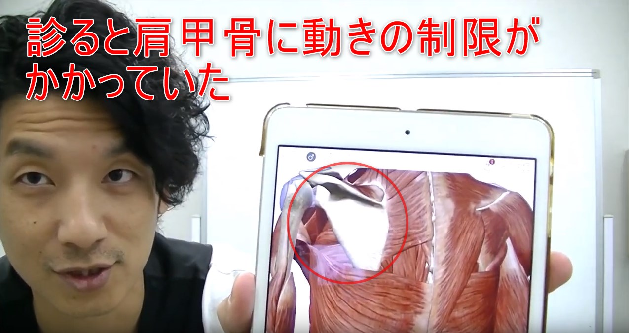 67-04_診ると肩甲骨に動きの制限がかかっていた