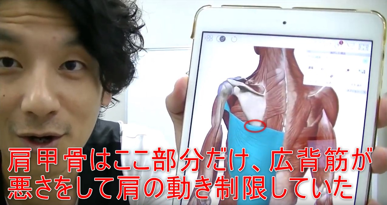 67-06_肩甲骨はここ部分だけ、広背筋が悪さをして肩の動き制限していた