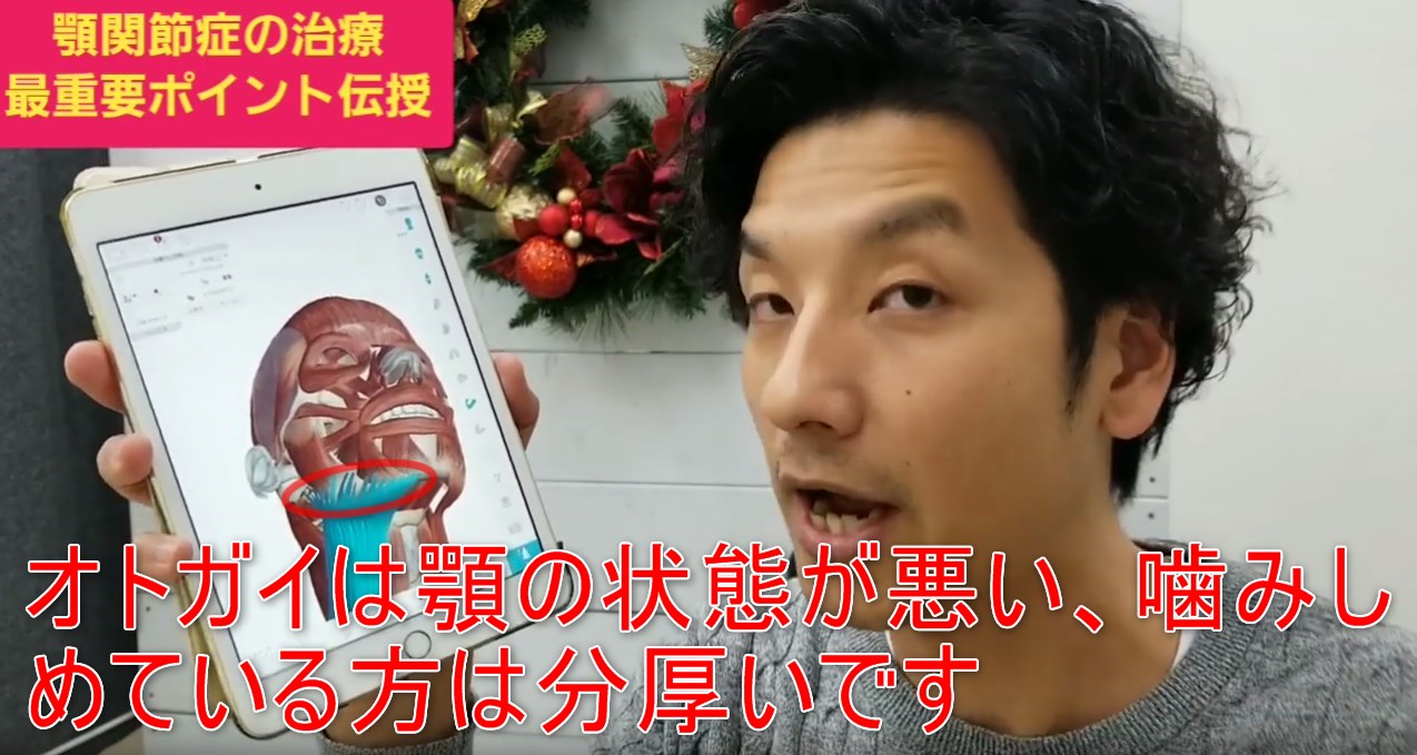 69-06_オトガイは顎の状態が悪い、噛みしめている方は分厚いです