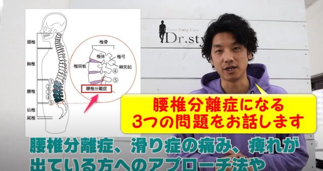 腰椎分離症、滑り症の原因は?3つの要素を解説