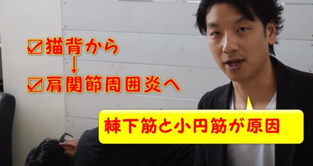 棘下筋と小円筋のアプローチ?猫背と肩関節周囲炎の関係について