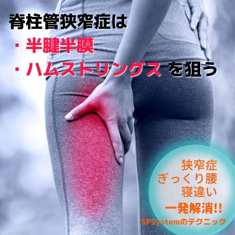 脊柱管狭窄症が一発で解消?ハムストリングスへのアプローチ法