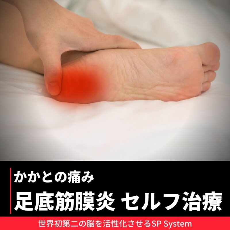 足底筋膜炎を改善する方法は？SP Systemを使ってセルフケア
