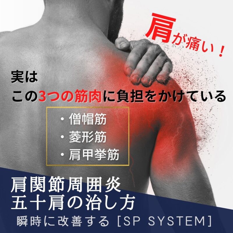片関節周囲炎に対して取り忘れている筋肉とは?3つのポイントを紹介